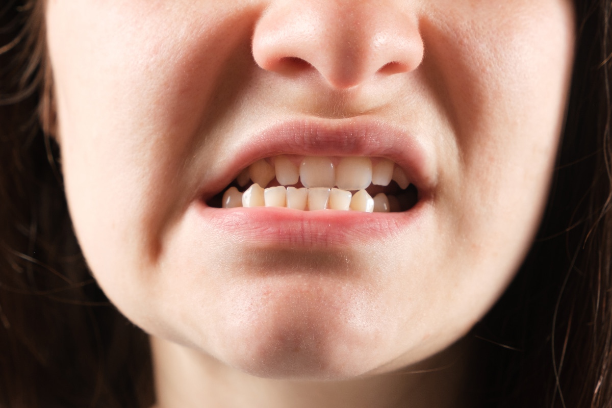 Zahn- und Kieferfehlstellungen