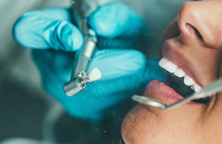 Wie kann Zahnstein entfernt werden?