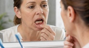 Recognizing an Infected Dental Implant—Symptoms, Causes, and When Treatment Is Necessary
